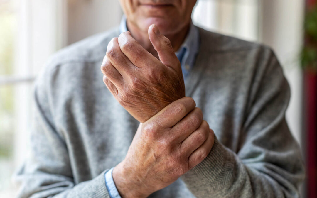 Does Physical Therapy Help With Arthritis?